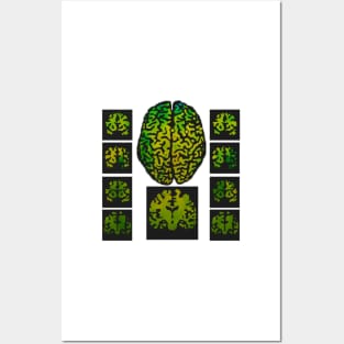 Brain Scanning  Imaging Greeting Card Posters and Art